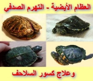 أمراض العظام الأيضية - التهرم الصدفي وعلاج كسور السلاحف