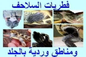 فطريات السلاحف والمناطق الوردية على الجلد 